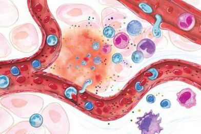 Effet du Boswellia sur les zones enflammées du corps